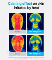 Ceutisome CC Mask
