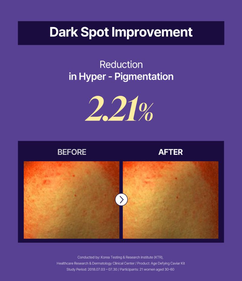 Age Defying Caviar Cream