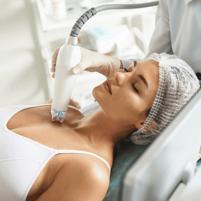 Add-On RF Microneedling on Decollete