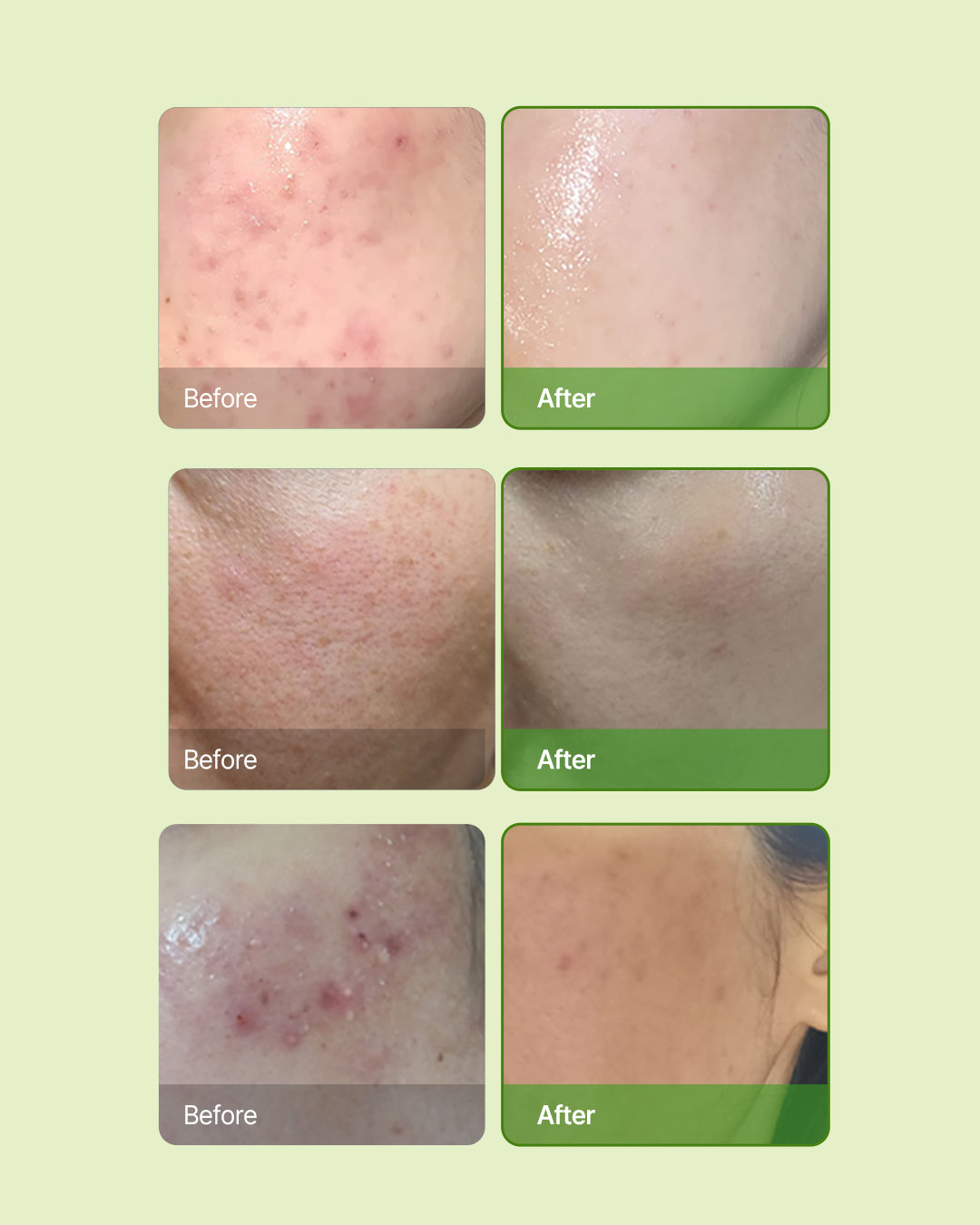 Skin Barrier Ato Cream Special Edition