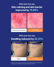 Sukalming Derma Kit
