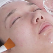 DOUBLE PEEL